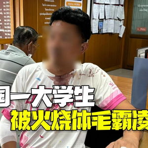 泰国大学生遭遇学长火烧体毛霸凌，反思校园安全与学生心理健康